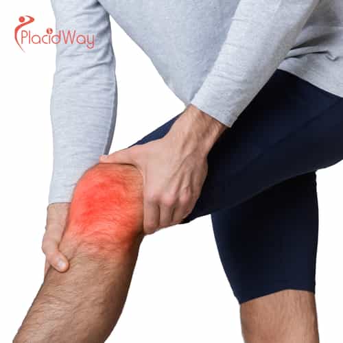 5 преимуществ восстановления мениска в Стамбуле, Турция